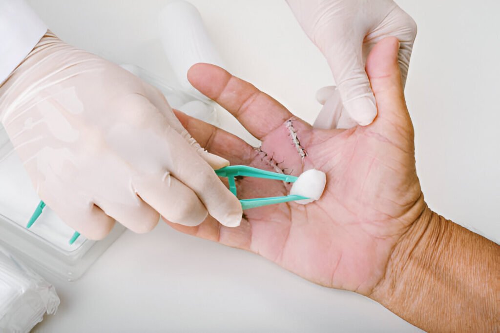 Surgical wounds care clinic at il